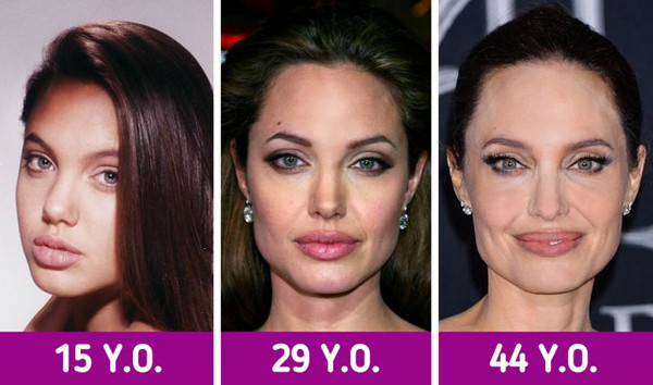 Môi. Theo tuổi tác, môi sẽ trở nên mỏng hơn và đường viền sẽ mờ đi do lượng collagen cơ thể tiết ra ít hơn. Ngoài ra, tim cực tím cũng ảnh hưởng bất lợi đến độ hấp dẫn của bờ môi.