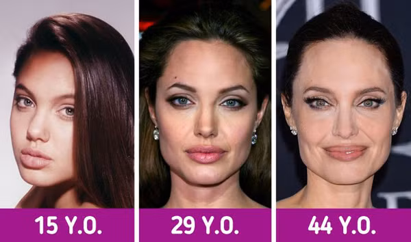 Môi. Theo tuổi tác, môi sẽ trở nên mỏng hơn và đường viền sẽ mờ đi do lượng collagen cơ thể tiết ra ít hơn. Ngoài ra, tim cực tím cũng ảnh hưởng bất lợi đến độ hấp dẫn của bờ môi.