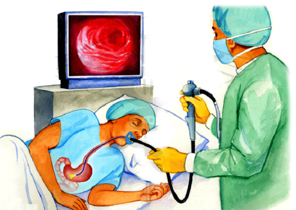 Có thể nói, ung thư trực tràng không phải là nguyên nhân duy nhất gây ra hiện tượng đi ngoài ra máu. Bạn nên nội soi trực tràng để phát hiện bệnh lý bất thường, bảo vệ sức khỏe. Ảnh: Internet.