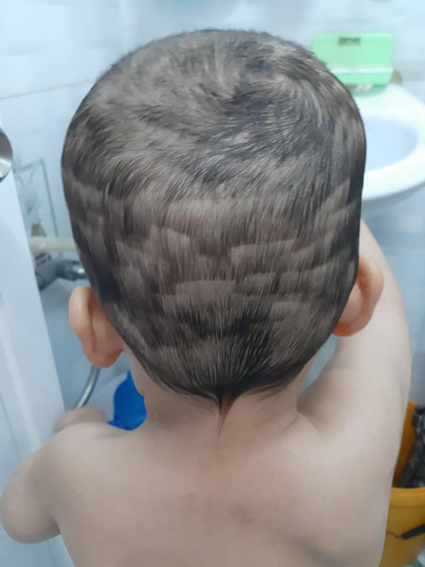 Không lượng sức mình, bố mẹ dùng kéo cắt tóc cho con. Kết quả là em bé có được “siêu phẩm” mô phỏng ruộng bậc thang.