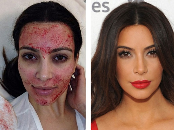 Ngôi sao người Mỹ trước khi làm phát hiện mình mang thai. Vì thế, cô không thể sử dụng kem gây tê hay thuốc giảm đau. Ảnh: Elle.