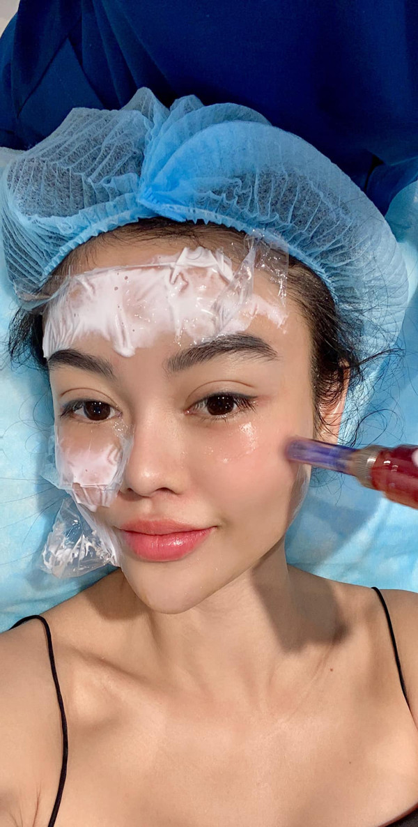 Dù vậy, phương pháp độc đáo này vấp phải không ít tranh cãi. Bản thân ngôi sao giải trí Kim Kardashian – người khiến phương pháp làm đẹp này được biết đến nhiều hơn từng thừa nhận cảm thấy hối hận khi dưỡng da bằng máu. Ảnh: FBVN.