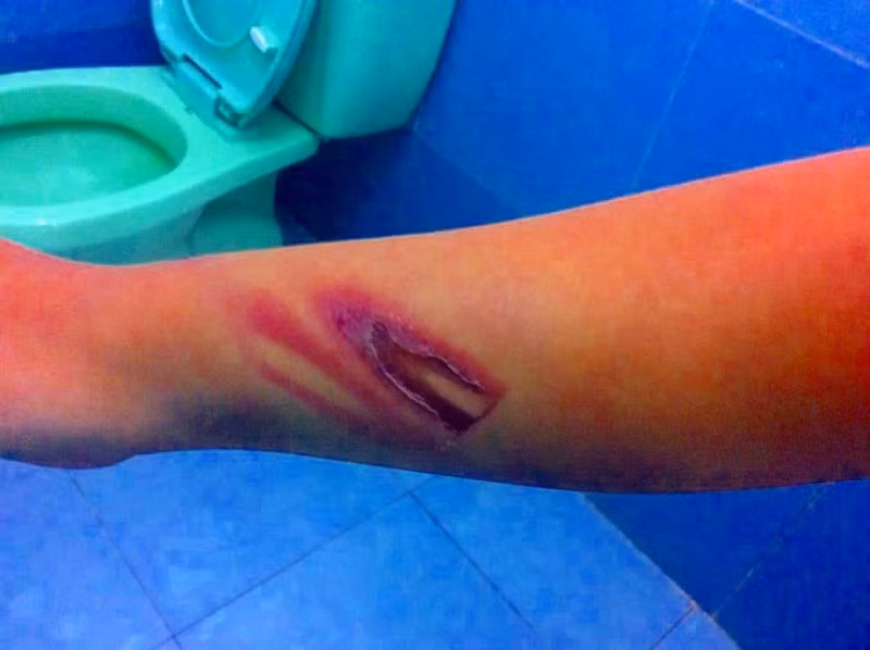 Than the be trai 11 tuoi ruom mau, lo loet vi bi thay chua danh dap da man-Hinh-4