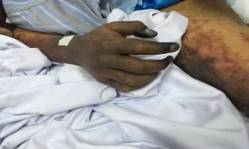 TT-Hue: Mot thanh nien tu vong do nghi mac lien cau lon