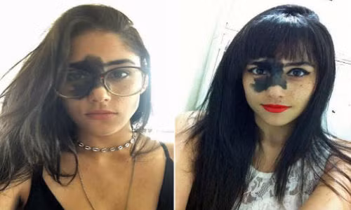 "Có người không thích chiếc bớt trên mặt tôi nhưng tôi không cảm thấy tức giận và buồn phiền. Đối với tôi nó tồn tại giống như một phần cơ thể, cho nên tôi càng mong muốn nhận được lời khen ngợi về nó".