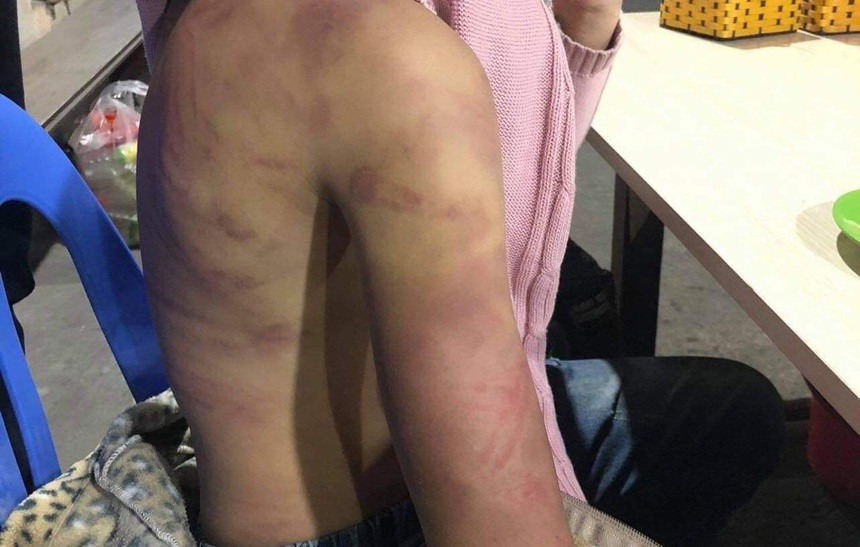 Be gai 12 tuoi bi nguoi tinh cua me ham hiep: 