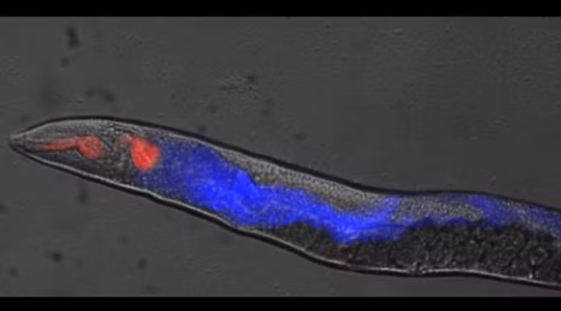 Cực choáng khả năng nghe âm thanh "thần thánh" của loài giun - Hình 5 Cuc choang kha nang nghe am thanh