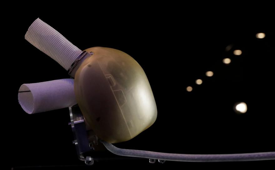 Theo các chuyên gia, quả tim nhân tạo này có thể hoạt động liên tục trong 5 năm.