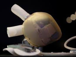 Tất cả các bộ phận đều ở trong quả tim, ngoại trừ bộ pin dùng cung cấp năng lượng ở bên ngoài cơ thể và được gắn ở thắt lưng rất gọn nhẹ.