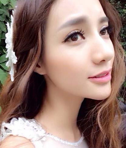 Dù bị nhiều fan phàn nàn nhưng bản thân Shu Wen lại cho rằng việc phẫu thuật thẩm mỹ làm cằm nhọn hoắt này khiến cô trông xinh đẹp hơn và phù hợp với công việc người mẫu ảnh.