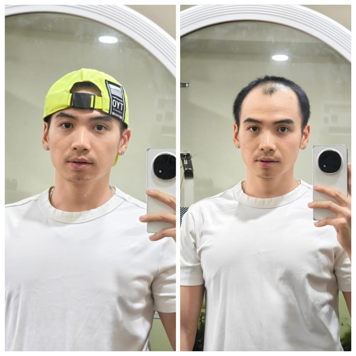 Chồng H’hen Niê chia sẻ: “Mọi người hay thắc mắc vì sao em hay đội nón, nhất là hôm đi event có các anh chị góp ý về việc này, em cũng ngại lắm, nhưng mà tóc em nó chỉ còn thế này thôi nên việc đội nón làm cho em tự tin hơn xí ạ”. Ảnh: FB Nguyễn Tuấn Khôi