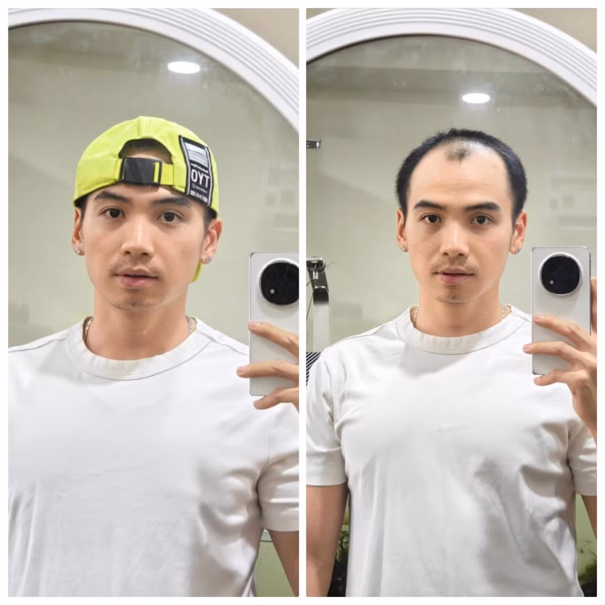 Chồng H’hen Niê chia sẻ: “Mọi người hay thắc mắc vì sao em hay đội nón, nhất là hôm đi event có các anh chị góp ý về việc này, em cũng ngại lắm, nhưng mà tóc em nó chỉ còn thế này thôi nên việc đội nón làm cho em tự tin hơn xí ạ”. Ảnh: FB Nguyễn Tuấn Khôi