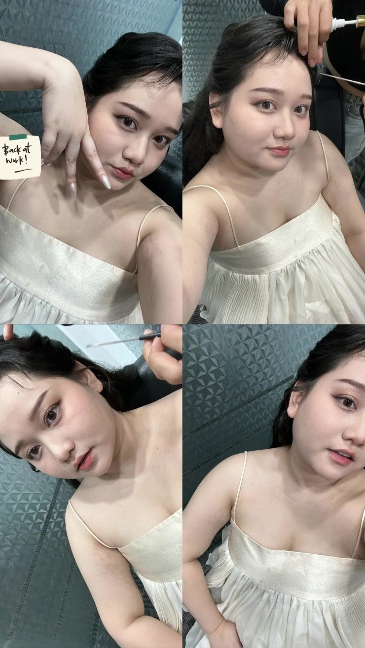 Thời gian qua, Trúc Anh cho biết cô đã giảm được cân từ 82 kg xuống 73 kg. Cô có hơn một năm tăng cân mất kiểm soát do trầm cảm, rối loạn ăn uống. Ảnh: IG trucanhhh_