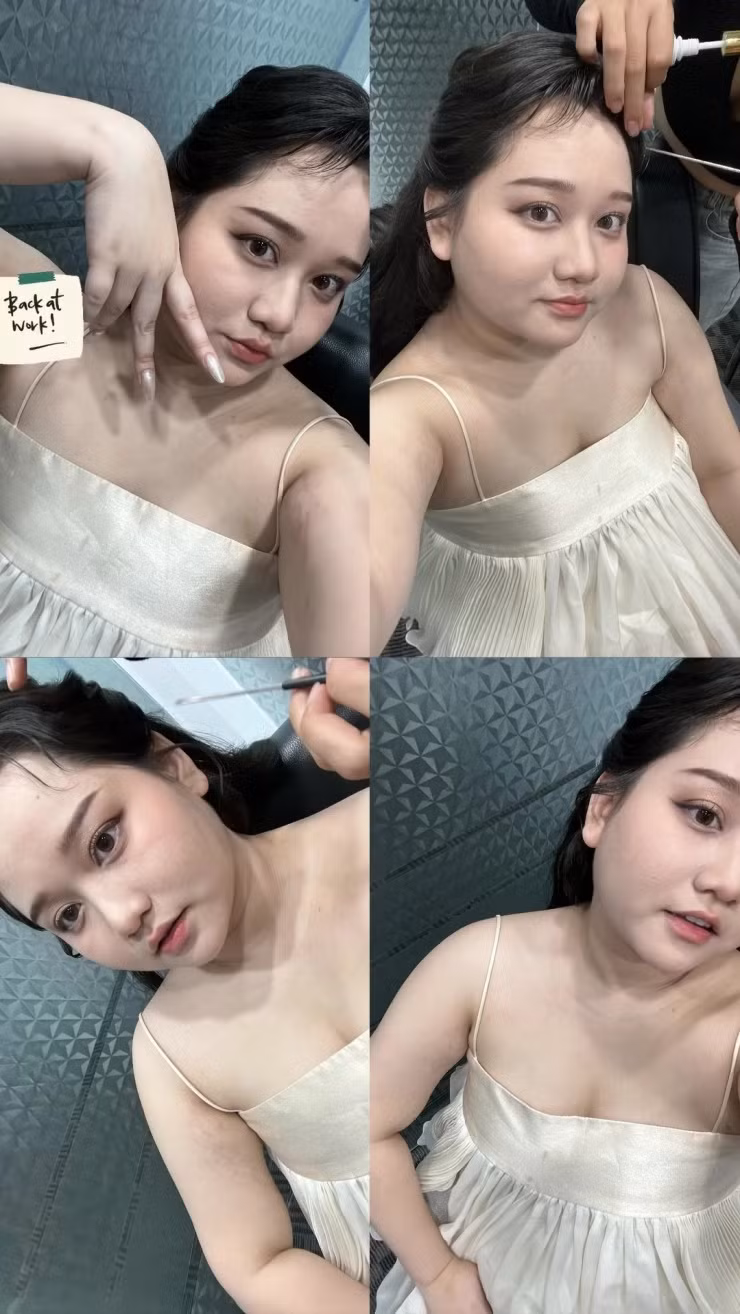 Thời gian qua, Trúc Anh cho biết cô đã giảm được cân từ 82 kg xuống 73 kg. Cô có hơn một năm tăng cân mất kiểm soát do trầm cảm, rối loạn ăn uống. Ảnh: IG trucanhhh_