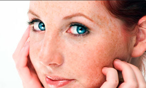 Da nhạy cảm thường xuất hiện nốt mẩn đỏ. Ảnh: Internet