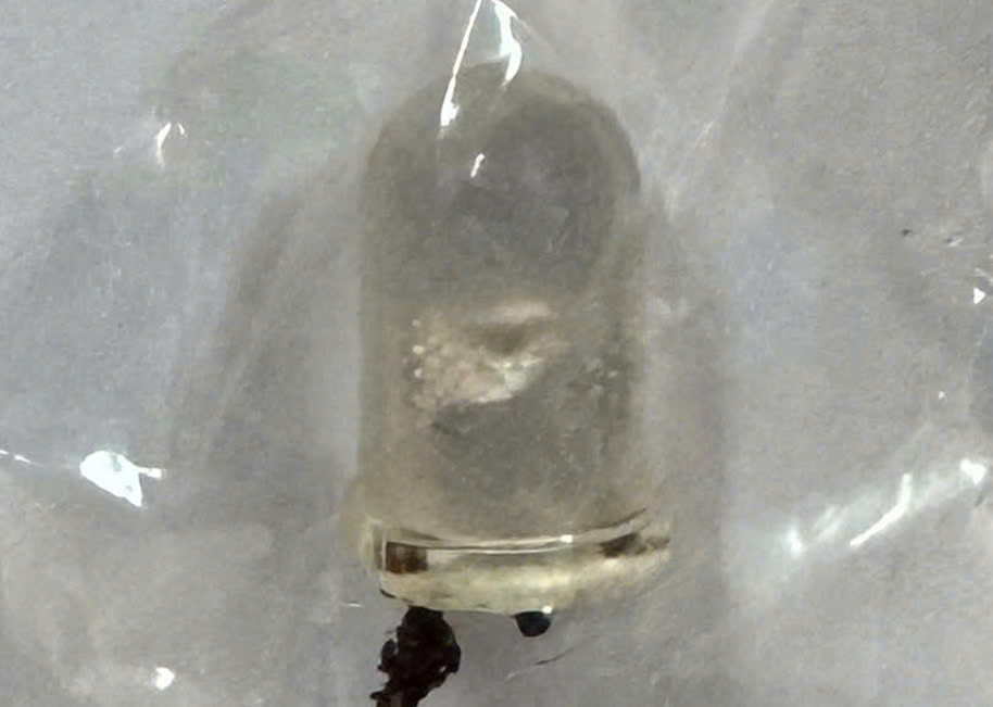 Dak Lak: Be trai 6 tuoi mac mot luc nhieu di vat duong tho