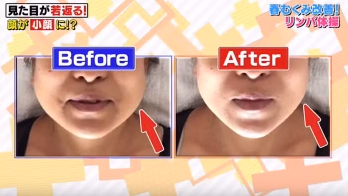 5 phut voi bai tap nang co mat kieu Nhat, mat banh bao cung thanh V-line-Hinh-10