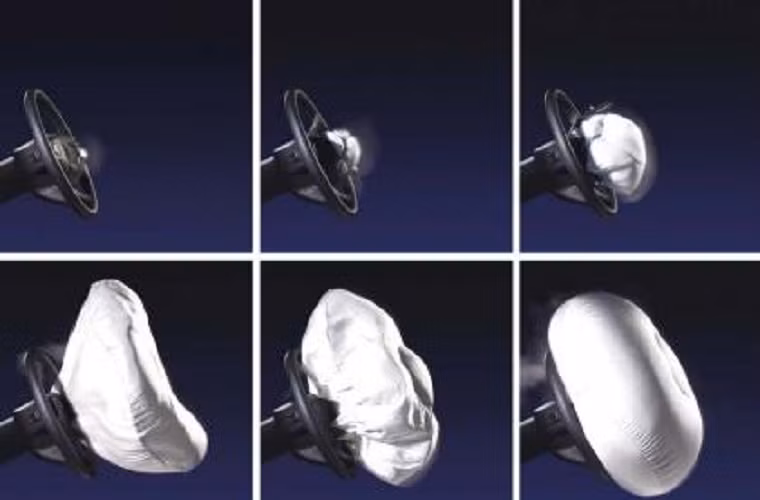 ABS điện tử (1978): Hệ thống tự động trên được Mercedes ứng dụng ở các mô hình xe cao cấp S-Class của nó.