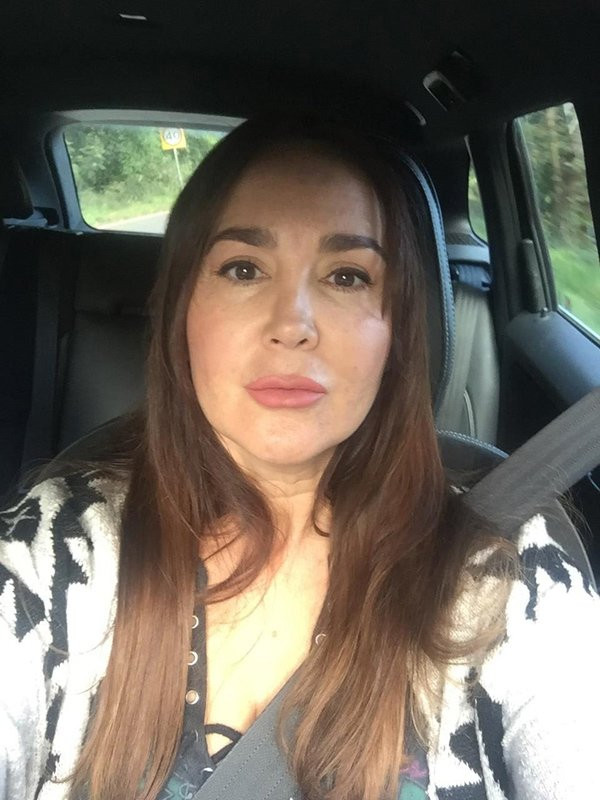 Cô đã bị liệt cơ mặt vĩnh viễn