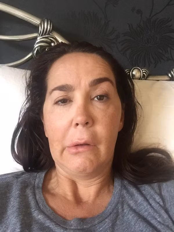 Gương mặt Belinda biến dạng sau khi chịu phản ứng từ botox.