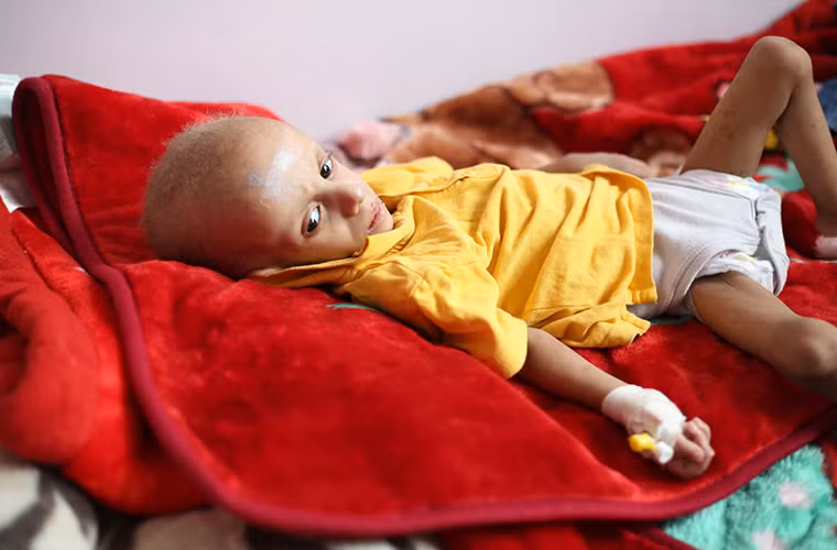 Được biết, khoảng 22,2 triệu người Yemen đang phải sống phụ thuộc vào viện trợ nhân đạo. Ngoài ra, khoảng 16 triệu người không được tiếp cận với nước sạch và y tế, 4,5 triệu trẻ em có thể không được đến trường. Ảnh: AJ.