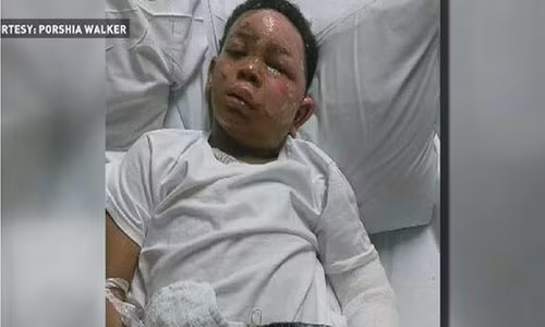 Bé Rondarius Barnhardt đến từ Bắc Carolina đang được điều trị tại bệnh viện. Ảnh: ATI.