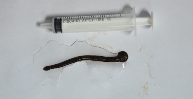 Hoang hon nhung truong hop dia chui vao nguoi kinh di-Hinh-4