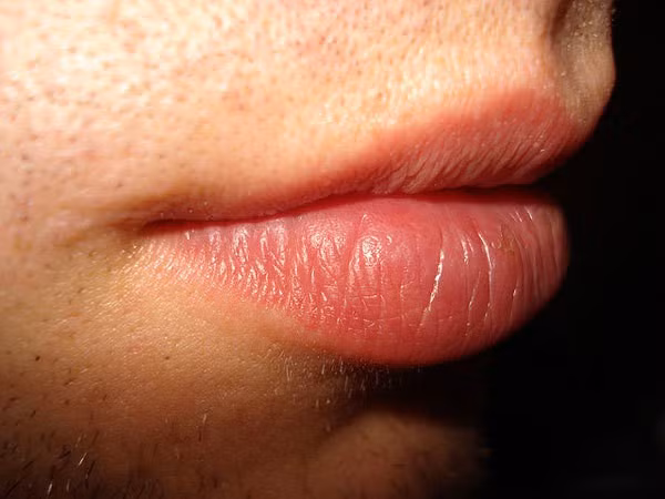 Tự làm hỗn hợp dưỡng môi tại nhà: Làn môi hồng mềm mại là điều ai cũng muốn có. Bạn có thể trộn một chút dầu quả hạnh với mật ong, đắp lên môi, mát-xa nhẹ nhàng rồi để qua đêm. Để trị khô môi hay nẻ môi, bạn có thể trộn Vaselin với dầu ôliu, sử dụng 3-4 lần/ngày. Hỗn hợp nước chanh và glycerin khi sử dụng qua đêm thường xuyên cũng sẽ giúp bạn có đôi môi rạng rỡ hơn.