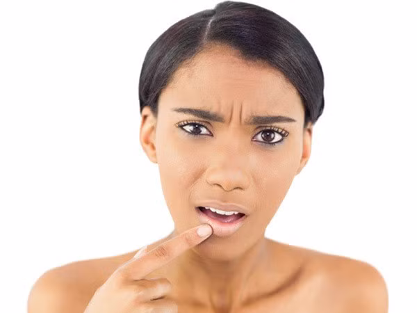 Loại bỏ các mụn rộp: Sự xuất hiện của mụn rộp là do virus herpes đơn dạng type 1 gây nên. Khoảng 90% số người trên thế giới đều có loại virus này nhưng ở dạng không hoạt động. Khi môi tiếp xúc với ánh nắng quá nhiều hoặc khi bạn bị ốm hay căng thẳng, chúng mới nổi lên thành các mụn rộp. Để loại bỏ các mụn rộp “đáng ghét” này bạn có thể sử dụng thuốc mỡ hay kem có thành phần từ chanh.