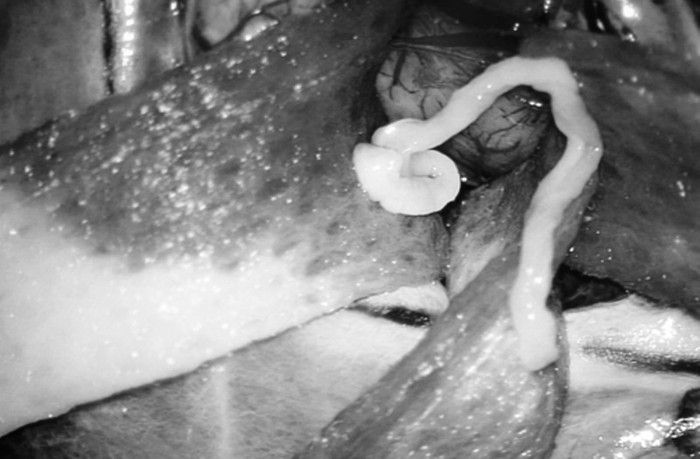 Ngày 20/12/2018, theo thông tin từ Bệnh viện ĐH Y Dược TP Hồ Chí Minh, các bác sĩ khoa Ngoại Thần kinh đã tiến hành lấy kí sinh trùng dài khoảng 7 cm trong não một người đàn ông ở Lâm Đồng. Trước khi đến khám, bệnh nhân có triệu chứng đau đầu, yếu nửa người kèm co giật.