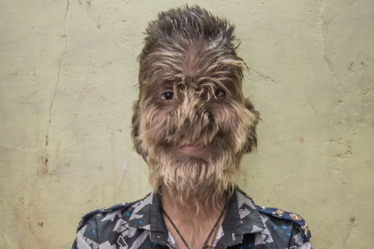 Thuoc trao nguoc khien 16 tre bien thanh nguoi soi nhu the nao?