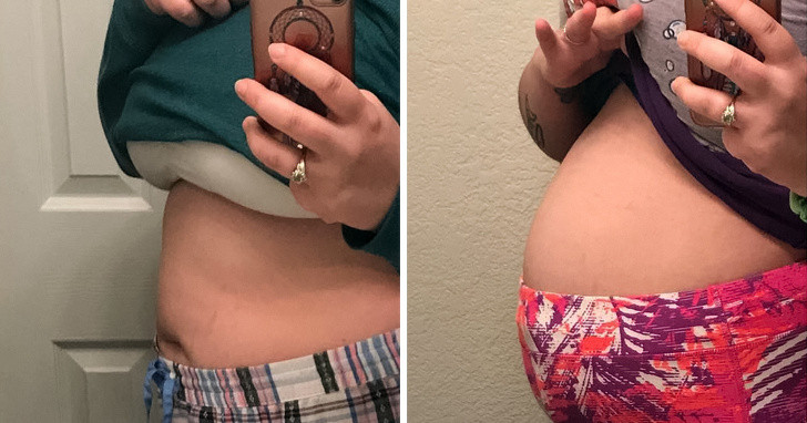 Bụng bị đầy hơi: Đối với một số phụ nữ, đầy hơi là một triệu chứng bình thường trong thời kỳ kinh nguyệt. Tuy nhiên, nếu bạn bị đầy hơi liên tục trong 2 tuần thì đó có thể là dấu hiệu cơ thể mất cân bằng. Bên cạnh đó, đầy hơi liên tục có thể là một dấu hiệu của ung thư vú hoặc ung thư buồng trứng. Đây là vấn đề sức khỏe nghiêm trọng bạn nên cẩn trọng.