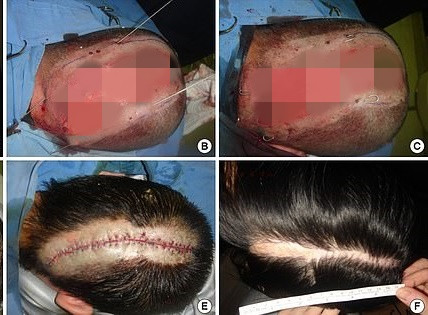 Kinh hoang co gai Han bi troc da dau chi vi nhuom toc