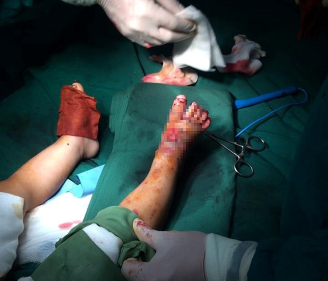 May cat co nha hang xom cat nat hai ban chan be 2 tuoi