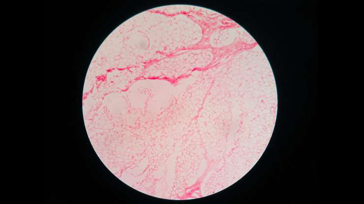 Nhiều người không bị các cơn đau hay tăng cân do ngồi nhiều, nhưng lại bị lão hóa sớm. Đặc biệt, ở phụ nữ ngồi nhiều trong suốt thời gian làm việc, các tế của họ bị lão hóa tới 8 năm so với tuổi thật.