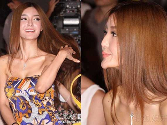 Lý Dĩnh Chi vốn được trời ban một nhan sắc kiều diễm hiếm có, nhưng cô lại tự tay phá hỏng nó bởi quyết định chạy theo trào lưu thẩm mỹ. Chiếc cằm V-line đã hại gương mặt cô bị biến chứng, trở nên dài nhọn bất thường.