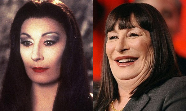 Nữ diễn viên đình đám Anjelica Huston vì muốn níu giữ tuổi thanh xuân nên đã tiêm rất nhiều botox, nhưng điều đó lại khiến đôi mắt kể từ đó không thể mở lớn, gương mặt cứng đơ cùng chiếc cằm bị biến mất.