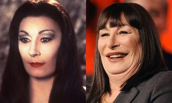 Nữ diễn viên đình đám Anjelica Huston vì muốn níu giữ tuổi thanh xuân nên đã tiêm rất nhiều botox, nhưng điều đó lại khiến đôi mắt kể từ đó không thể mở lớn, gương mặt cứng đơ cùng chiếc cằm bị biến mất.