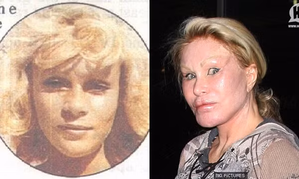 Ca sĩ Jocelyne đã trải qua rất nhiều đau đớn từ những cuộc phẫu thuật. Nữ ca sĩ đã chi hàng triệu đô la cho làm mắt, bơm môi, căng da mặt, tuy nhiên bà lại phải trả cái giá quá đắt khi lạm dụng “dao kéo”, mí mắt bị kéo căng thậm chí không thể nhắm mắt lại khi ngủ, nhìn vô cùng đáng sợ.