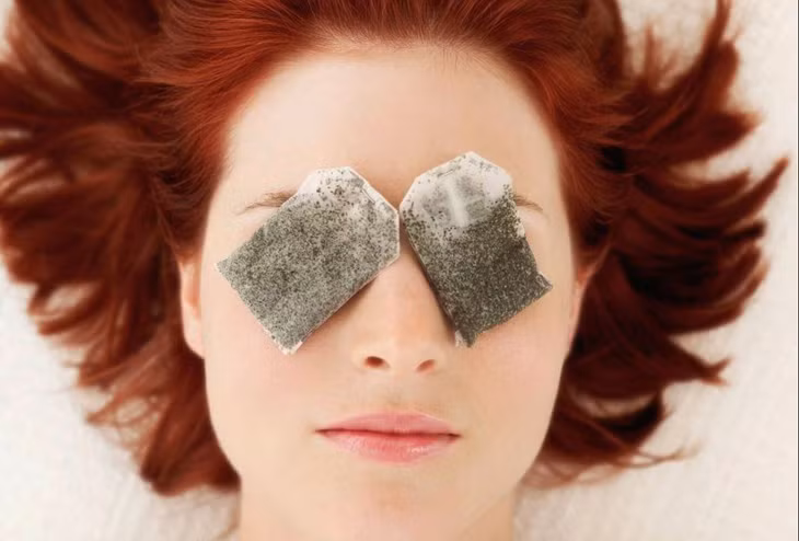 Đắp túi trà: Bạn chỉ việc lấy túi lọc của trà xanh hay trà hoa cúc rồi thả vào nước sôi trong vòng 3 phút cho trà ngấm. Sau đó để nguội túi lọc, cất vào tủ lạnh. Khi dùng bạn đắp hai túi lọc đã ướp lạnh lên mắt, thư giãn trong 15 phút và rửa sạch.