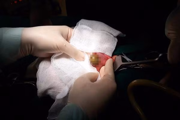 Khong muon nhiem doc, tac ruot, nhung nguoi nay tuyet doi khong an mang