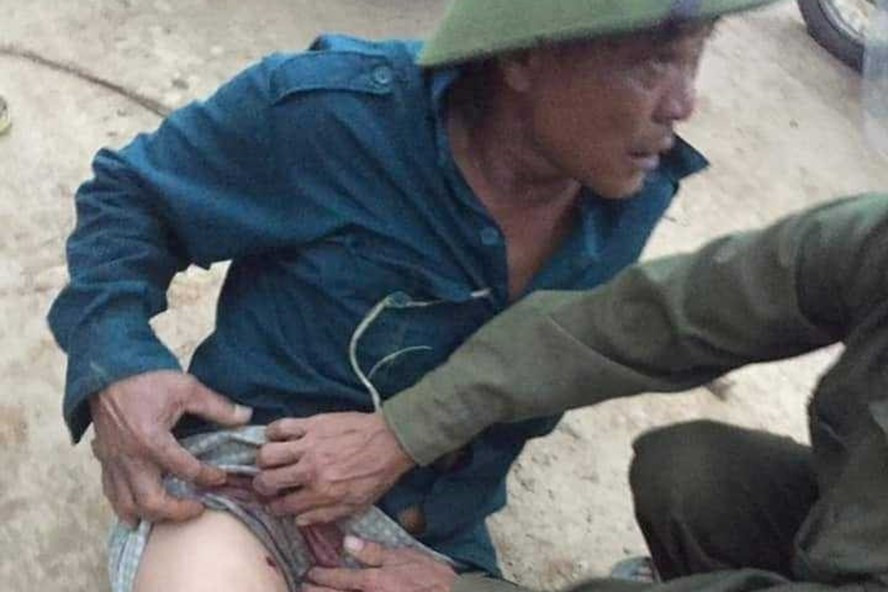 Tam giu nghi pham ban 3 vien dan vao nguoi dan ong di rung ve