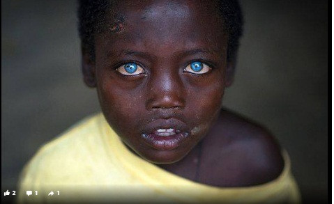 Cậu bé da đen thu hút mọi ánh nhìn với đôi mắt xanh ngắt.