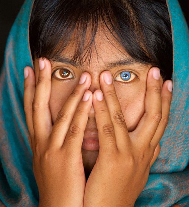 Hội chứng Waardenburg có thể khiến con người có đôi mắt xanh sáng.