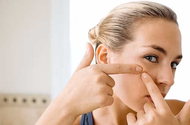 Không nặn mụn: Mọc mụn là một vấn đề lâu đời mà nhiều người trong chúng ta phải đối mặt. Việc nặn mụn sẽ dẫn đến sẹo và đó là một điều không nên nếu bạn muốn có vẻ đẹp tự nhiên mà không cần trang điểm.