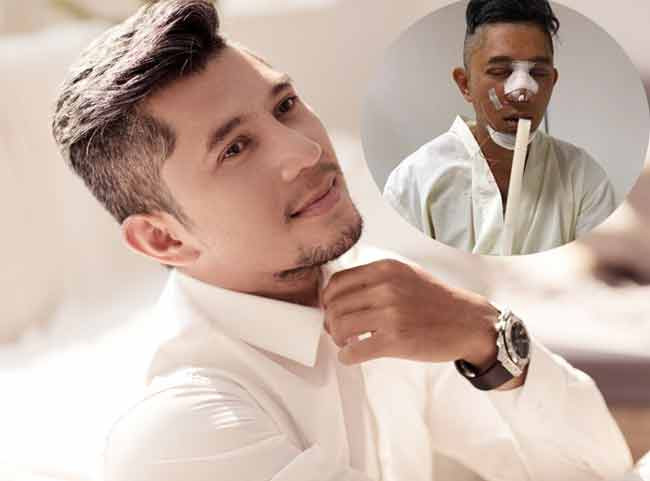 Lương Bằng Quang là một trong những nghệ sỹ nam tiên phong công khai phẫu thuật thẩm mỹ để cải thiện nhan sắc. Không chỉ gây ồn ào dư luận bằng cuộc tình với hot girl 98, mới đây, ca sĩ - nhạc sĩ Lương Bằng Quang còn công khai việc "dao kéo" để sửa sang lại khuôn mặt của mình.