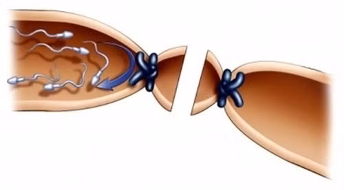 Bac si he lo nguyen nhan du chong that ong dan tinh nhung vo van mang thai