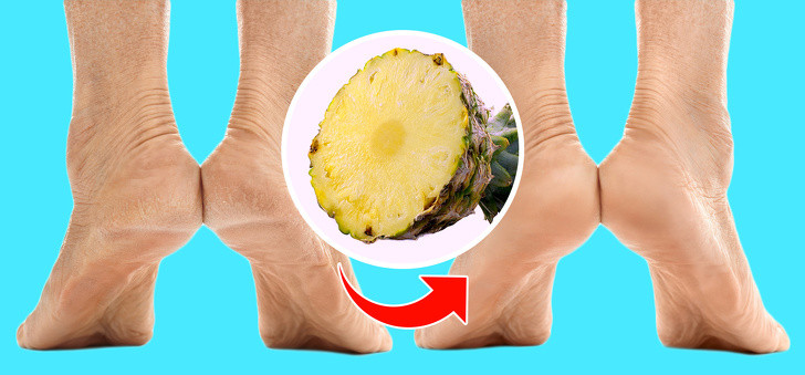 Chà vết chai cứng đầu với dứa, nồng độ axit và kết cấu của nó sẽ dễ dàng tẩy da chết.