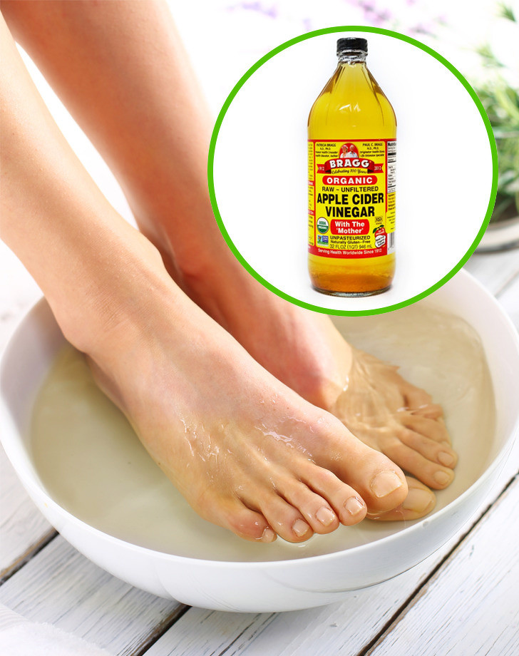 Ngâm chân trong giấm táo để tránh mùi hôi.