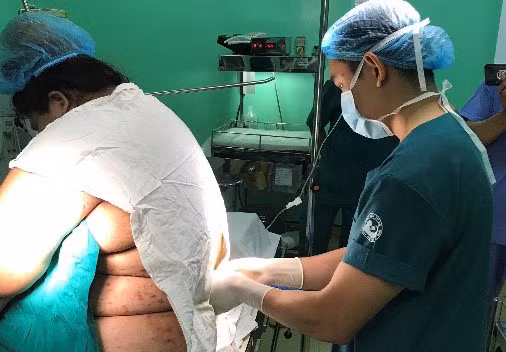 Canh bao nhung ca sinh mo dac biet nguy hiem vi san phu “qua kho”